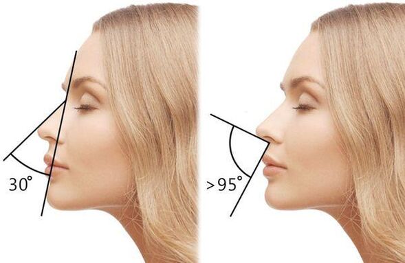 meranie uhla nosa